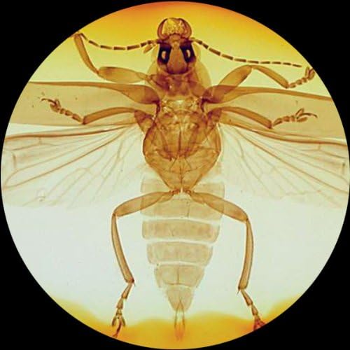 AmScope SE306R-PZ Microscopio estéreo binocular frontal, oculares WF10x y WF20x, aumento 10X-80X, objetivos 2X y 4X, fuente de luz halógena superior e inferior, soporte de pilar, 120 V, blanco